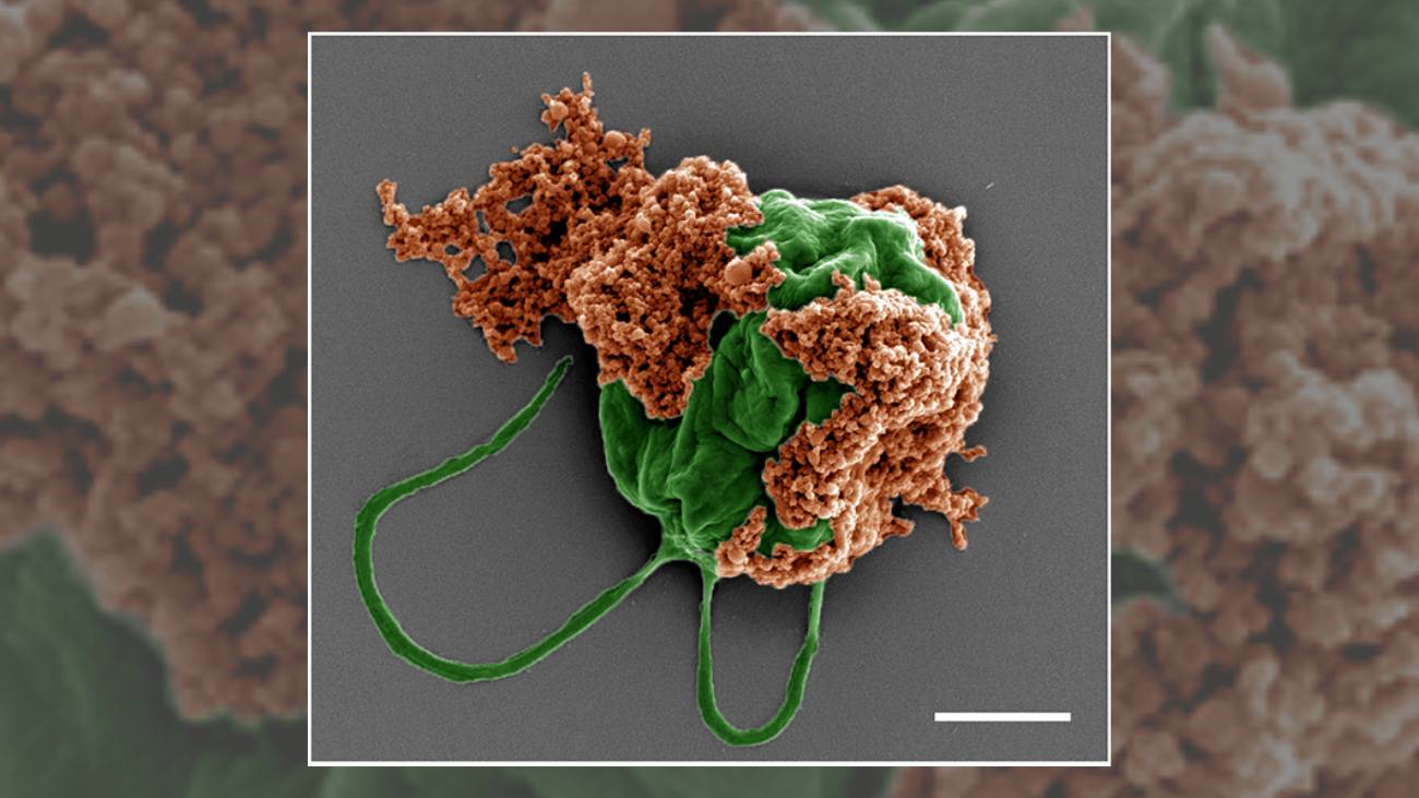 Microscopische foto van een microrobot die uitgezaaide longtumoren behandeld. In groen is de algencel zichtbaar, in bruin de nanodeeltjes met daarin het kankermedicijn.