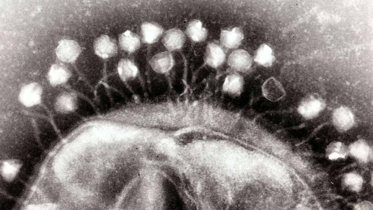 bacteriofagen op een bacteriële cel, gemaakt met een elektronische microscoop