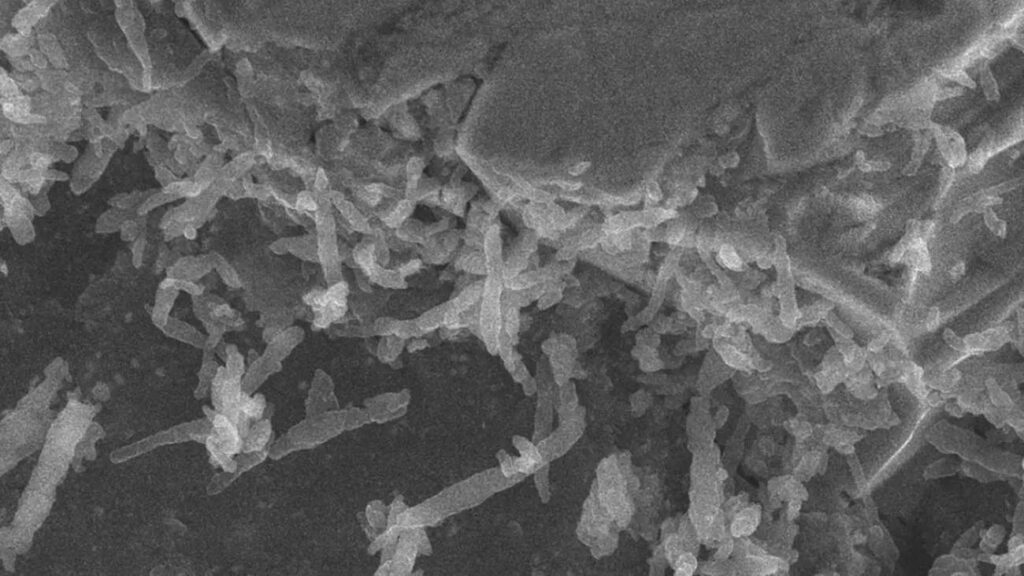 De bacteriën op de Ryugu-asteroïde, gemaakt met een scanning-elektronenmicroscoop