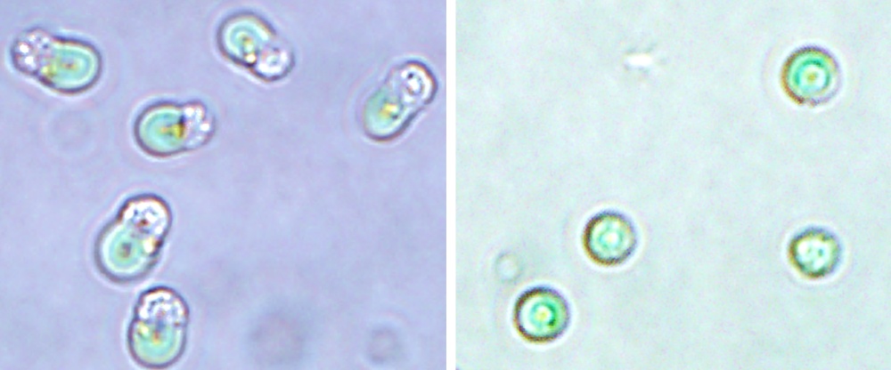 De algensoort Cyanidioschyzon merolae (links) en zijn bladgroenkorrels (rechts).